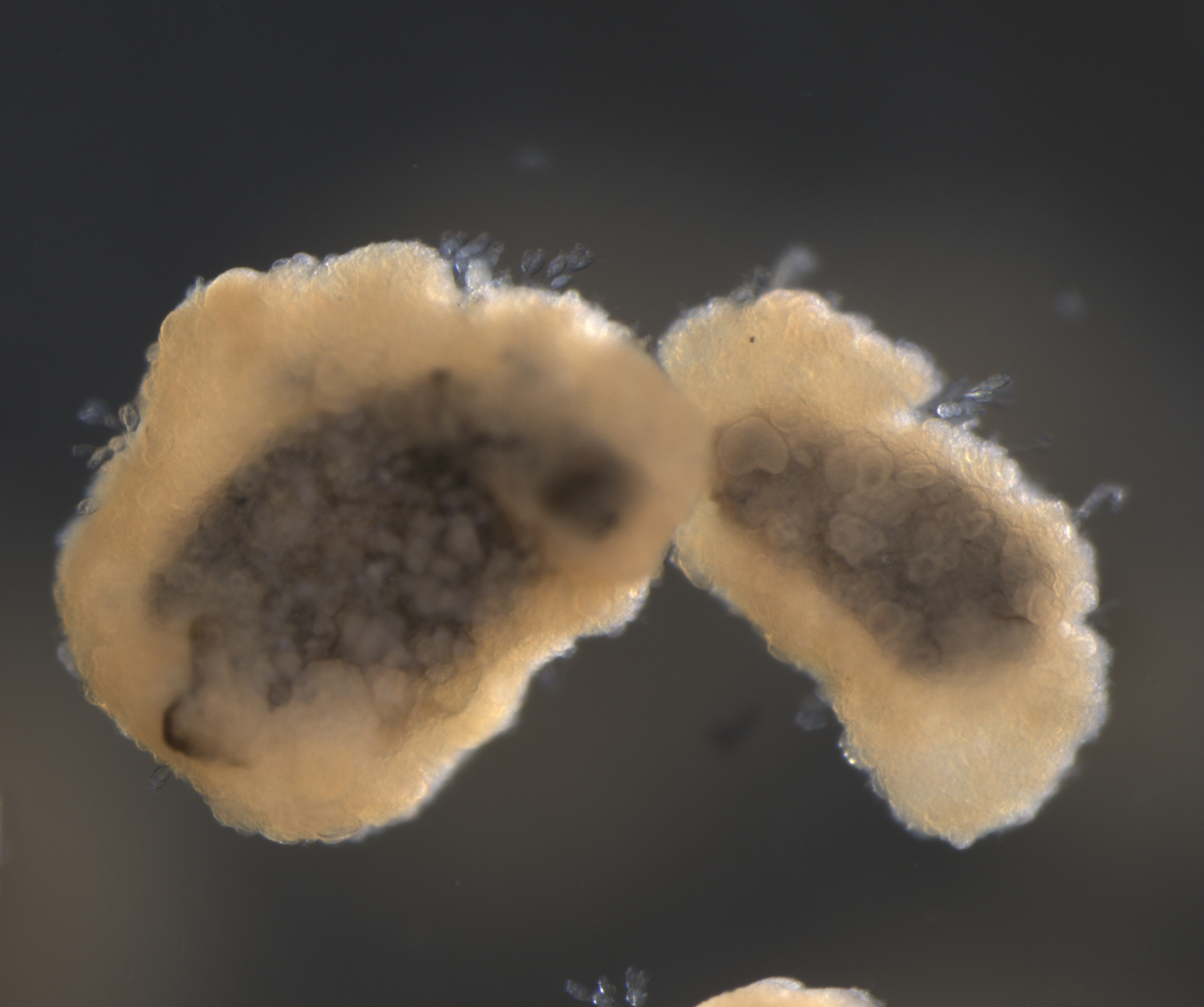 Fremtiden inden for MBBR